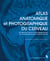 Atlas anatomique etphotographique ducerveau - 42 planches (dont 41 photographiques) de neuroanatomie etde neurosciences