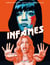 Infâmes