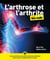 L'arthrose et l'arthrite pour les nuls