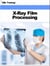 X-Ray Film Processing (X-Ray and Radiology) - X-Ray and Radiology