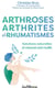 Arthrose, arthrite et rhumatismes : Solutions naturelles et mesures préventives
