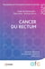 Cancer du rectum - Rapport présenté au congrès commun 3CVD 2025