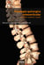 Patologia quirúrgica osteoarticular - Membre superior i raquis