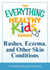 Rashes, Eczema, and Other Skin Conditions - A troubleshooting guide to common childhood ailments