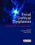 Focal Cortical Dysplasias - New advances for curing epilepsy