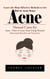 Acne: Learn the Most Effective Methods to Get Rid of Acne Scars (Natural Cures for Acne - How to Cure Acne Using Natural Homemade Remedies and Treatments)