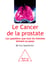 Le Cancer de la prostate - Les questions que tous les hommes doivent se poser