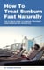 How To Treat Sunburn Fast Naturally