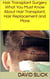 Hair Transplant Surgery - What You Must Know About Hair Transplant, Hair Replacement and More