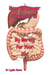 How To Lower Cholesterol by Taking Care of Your Gut - How To Do Books