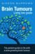 Brain Tumours: Living Low Grade