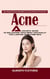 Acne: Easy Natural Home Remedies for Acne & How to Prevent It (A Holistic Guide to Balancing Your Body Naturally for Lasting Acne-free Skin)