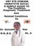Dry Eye Disease, (Keratitis Sicca)  A  Simple  Guide  To  The Condition, Diagnosis, Treatment  And  Related Conditions