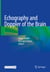 Echography and Doppler of the Brain