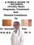 A  Simple  Guide  To  Miliaria, (Prickly Heat)  Diagnosis, Treatment  And  Related Conditions