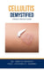 Cellulitis Demystified: Doctor's Secret Guide