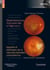 Dégénérescence maculaire liée à l'âge (DMLA) (volume 7 - coffret Rétine) - Myopie et étiologies de la néovascularisation choroïdienne