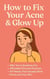 How to Fix Your Acne & Glow Up