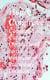 Consumption Curable - Observations on the treatment of Pulmonary Diseases