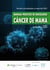 Manual práctico de oncología - Cáncer de mama