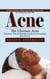 Acne: A Holistic Guide to Balancing Your Body Naturally for Lasting Acne-free Skin (The Ultimate Acne Treatment, Diet & Remedies Guide for Overcoming Acne Forever)