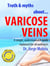 Truth & Myths About... Varicose Veins - La Medicina hecha fácil - Medicine Made Easy, #2
