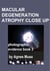 Macular Degeneration Atrophy Close Up, Photographic Evidence Book 3 - Macular Degeneration Atrophy, Photographic Evidence Series of   Books, #19