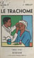 Le trachome