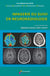 Imagerie du suivi en neuroradiologie