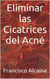 Eliminar las Cicatrices del Acné