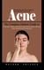Acne: The Ultimate Acne Cure Guide for Becoming Acne Free for Life (The Complete Holistic Guide to Heal Acne, Balance Hormones, and Achieve Clear, Glowing Skin Naturally and Permanently)