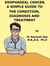 Esophageal Cancer,  A  Simple  Guide  To  The Condition,  Diagnosis  And  Treatment