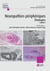 Neuropathies périphériques : étiologies - Volume 2