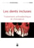 Les dents incluses - traitement orthodontique et chirurgical