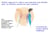 Holistic Approach to Relieve Neck Pain, Back, and Shoulder Pain: An Effective Method for Pain Reduction