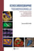 Echocardiographie tridimensionnelle