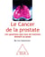 Le Cancer de la prostate