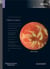 Inflammation