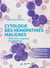 Cytologie des hémopathies malignes - anomalies sanguines et médullaires