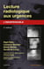Lecture radiologique aux urgences - l'indispensable