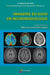 Imagerie du suivi en neuroradiologie
