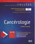 Cancérologie (2e édition)
