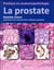 Pratique en anatomopathologie : la prostate
