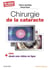 Chirurgie de la cataracte - 80 vidéos séquencées