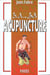 Acupuncture