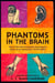 Phantoms in the brain