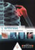 L'arthrose : de la clinique au traitement