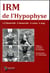 IRM de l'hypophyse