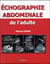 Échographie abdominale de l'adulte