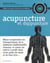 Acupuncture et digipuncture